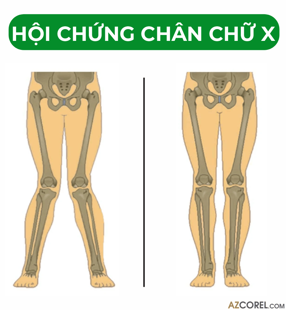 272 demo poster kien thuc ve xuong gym 9.png