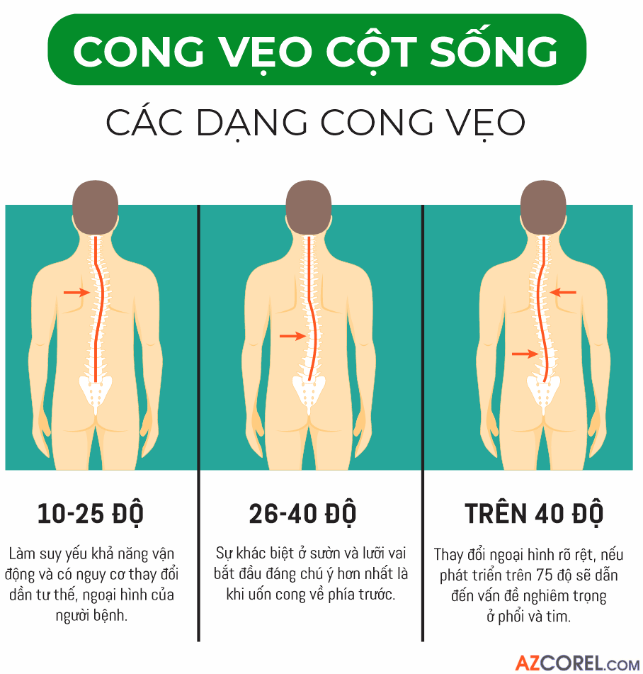 272 demo poster kien thuc ve xuong gym 8.png